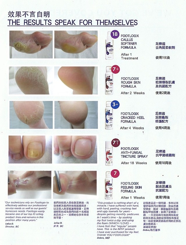 FOOTLOGIX SPIRALEEN NAIL TINCTURE ANTI FUNGUS POUR LES ONGLES 50ML 44G 0