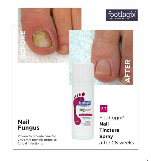 FOOTLOGIX SPIRALEEN NAIL TINCTURE ANTI FUNGUS POUR LES ONGLES 50ML 44G 0